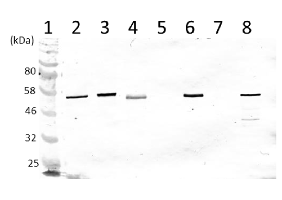 Western blot using anti-V ATPase subunit A and B antibodies